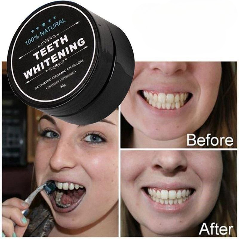 1 caja de polvo blanqueador de - Teeth Whitening Pens reseña y precio